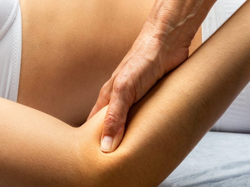 querfriktion nach cyriax